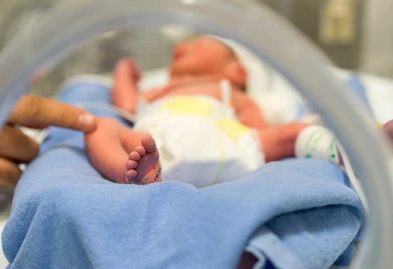 Premature baby receiving care in hospital