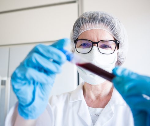 medical researcher looking at blood sample