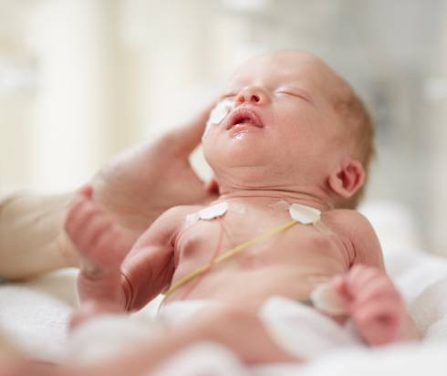Newborn baby in critical care